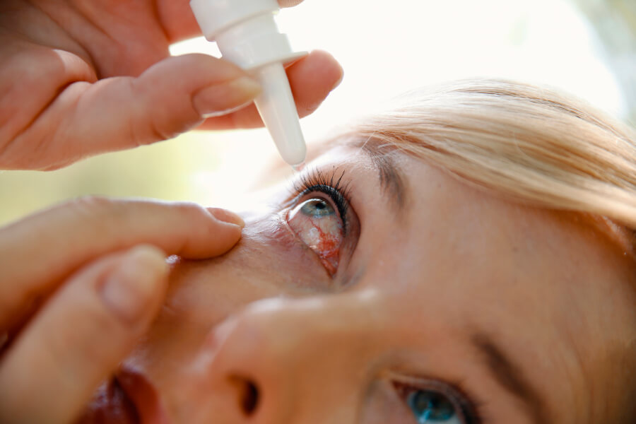 conjuntivitis-ojos-rojos-verano